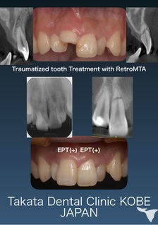 高田歯科 神戸三宮の歯科衛生士求人の画像（5枚目）