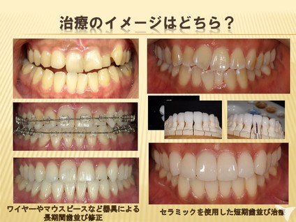 矯正治療の種類が多い