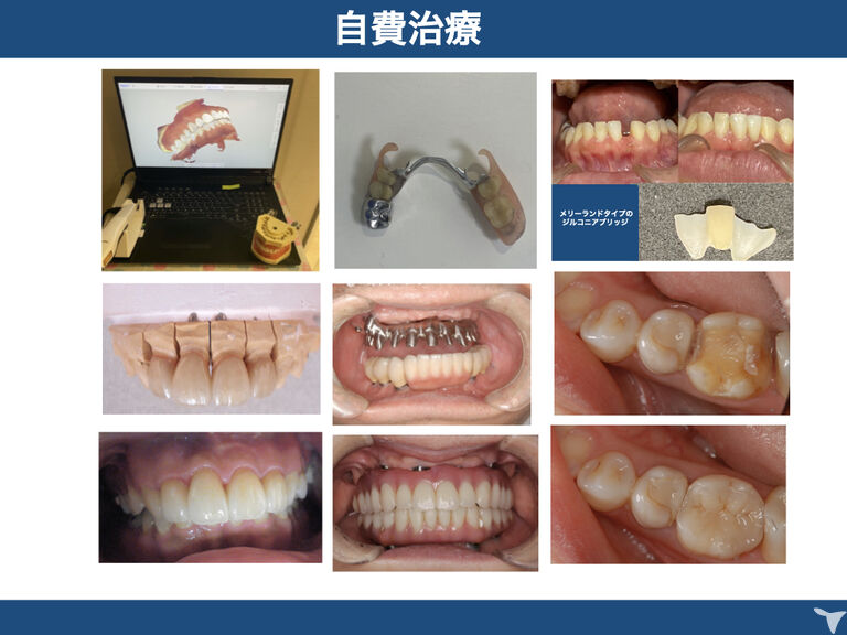 自費治療も多いです