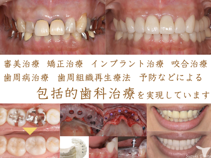 包括的歯科治療を実現