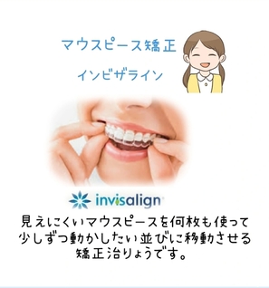 マウスピース矯正