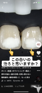 ホワイトスポットICON