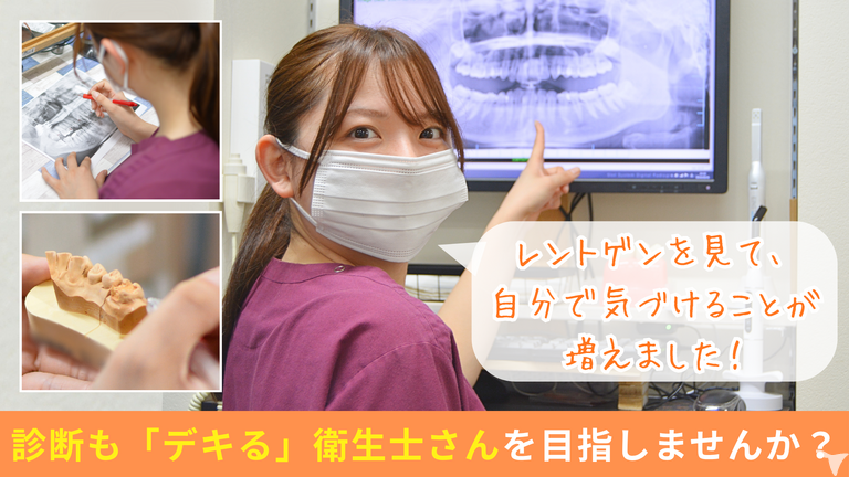 治療を理解できる衛生士