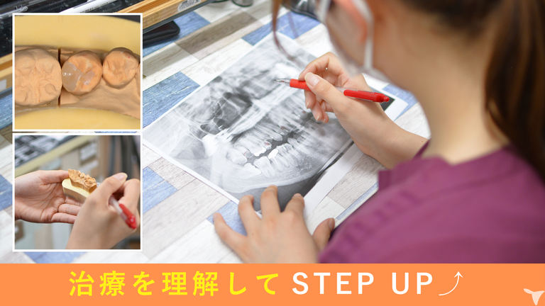 治療を知ると、もっと楽に