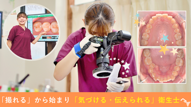 写真から広がる衛生士の力