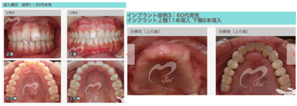 当院治療例