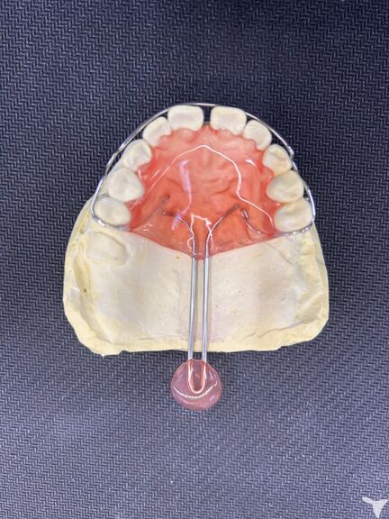 軟口蓋挙上装置
