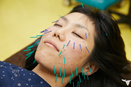 つつみ鍼灸整骨院の鍼灸師求人の画像（2枚目）