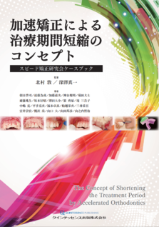 スピード矯正治療