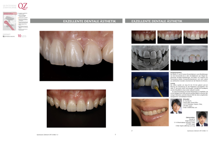 世界最高峰の歯科補綴誌！