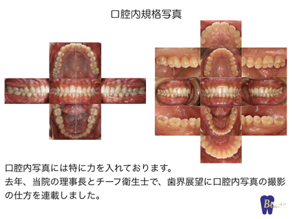 口腔内規格写真撮影