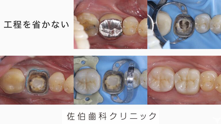 省略しない治療