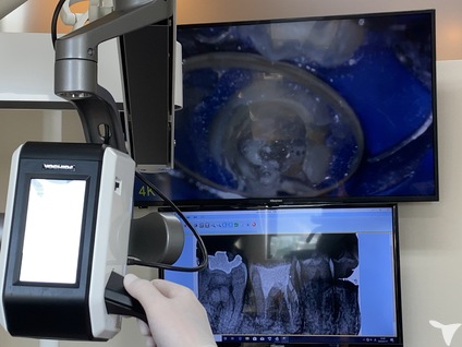 マイクロスコープ