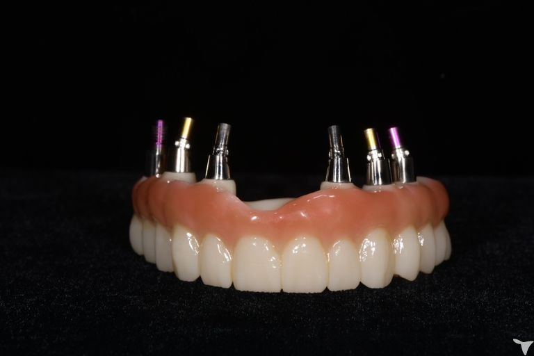 株式会社エスラボの歯科技工士求人の画像（5枚目）