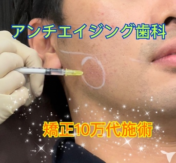 アンチエイジング歯科
