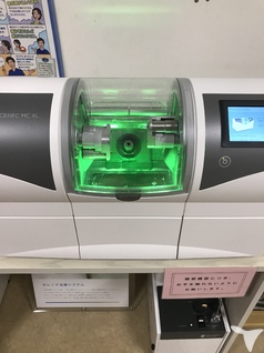 セレック最新バージョン！