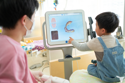 iteroもあります