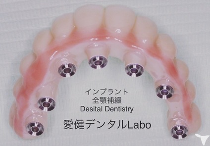 愛健歯科医院の歯科技工士求人の画像（4枚目）