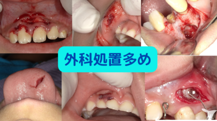 一般歯科で外科処置多め
