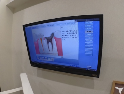 説明用アニメーション