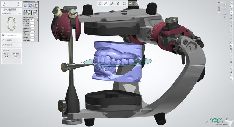 3Shapeを使用します