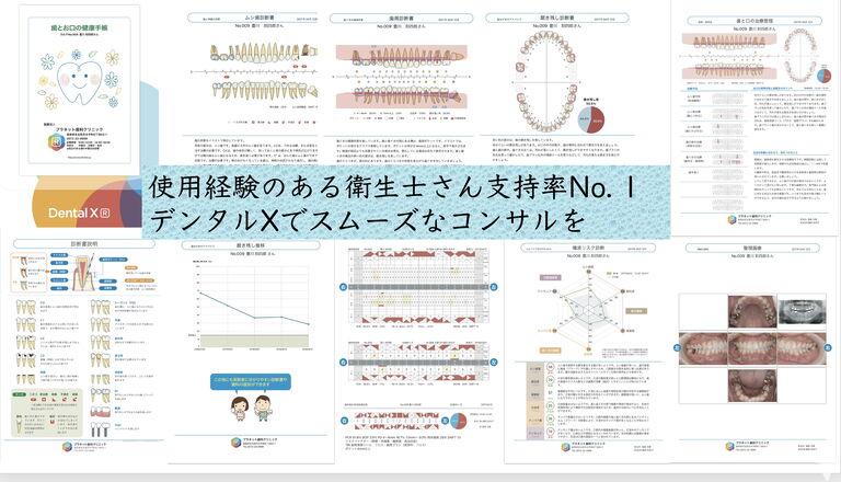 デンタルX 治療計画立案