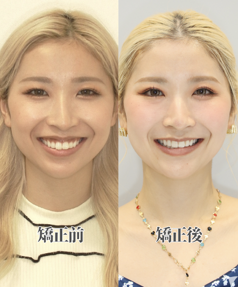  青山表参道矯正歯科クリニックの歯科衛生士求人の画像（4枚目）