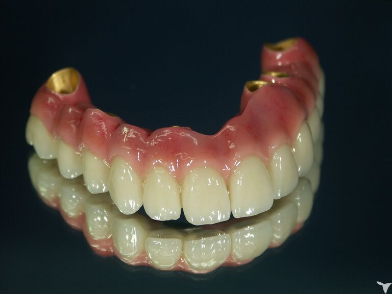 kougo ceramics yasukunistreet dental lavoratoryの歯科技工士求人の画像（5枚目）