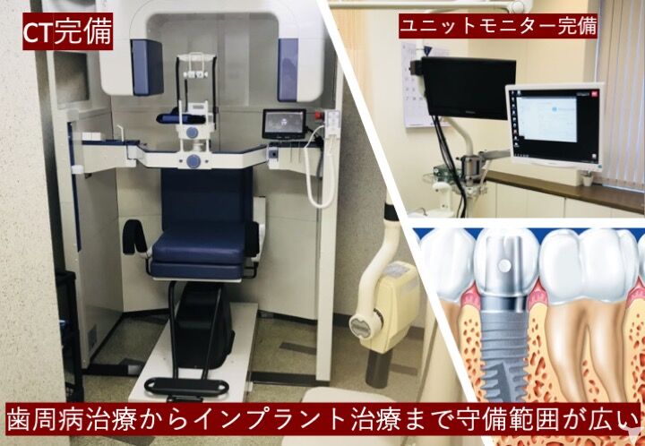 院内CT